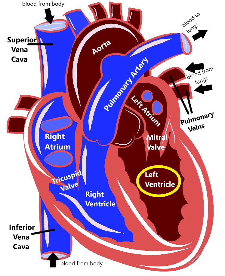 familial-dilated-cardiomyopathy-patient-library